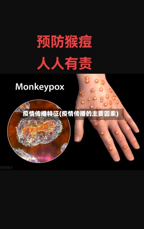 疫情传播特征(疫情传播的主要因素)-第3张图片