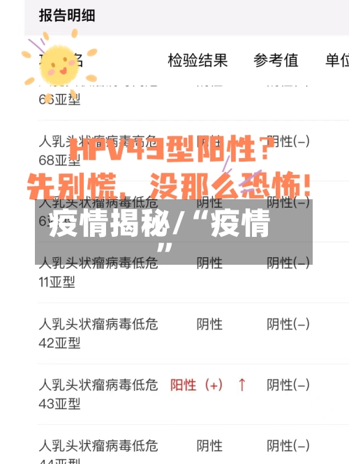 疫情揭秘/“疫情	”-第2张图片