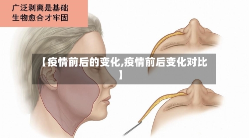 【疫情前后的变化,疫情前后变化对比】-第3张图片