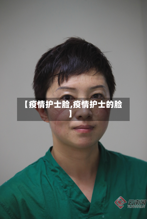 【疫情护士脸,疫情护士的脸】-第2张图片