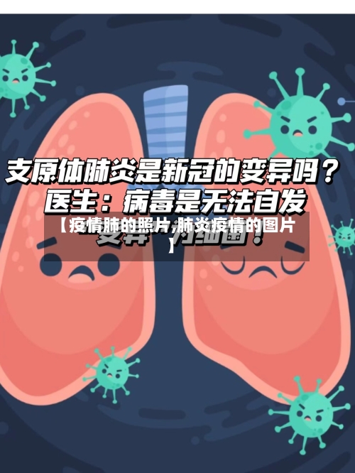 【疫情肺的照片,肺炎疫情的图片】-第3张图片