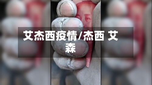 艾杰西疫情/杰西 艾森
